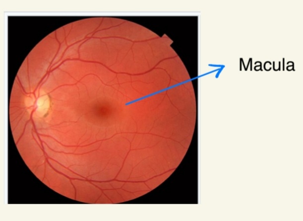 Macular